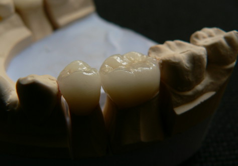 Zahnbehandlug